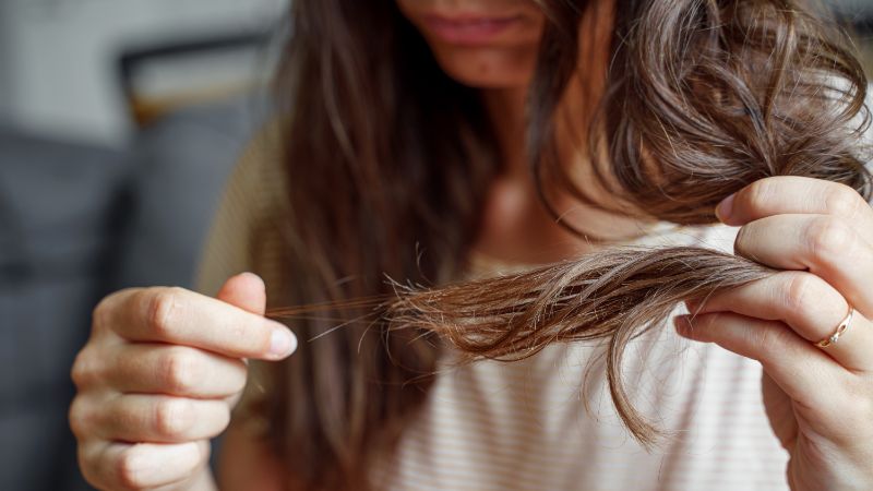 cabello seco y caída del cabello